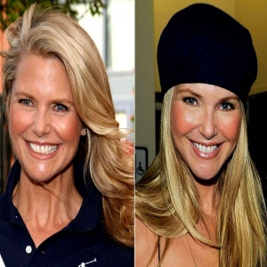 Christie Brinkley Plastic Surgery Before And After Pictures Brasizemeasurements Org