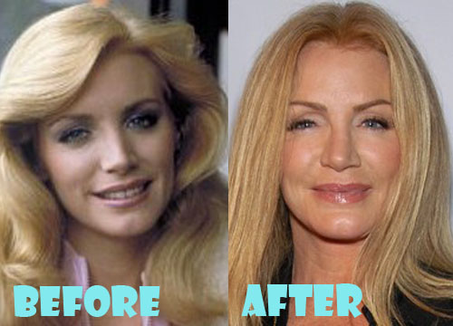 Shannon Tweed Addicted to Plastic Surgery