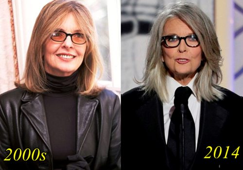 Diane Keaton Plastic Surgery Before After
