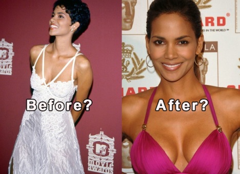 Halle Berry Plastic Surgery Before After
