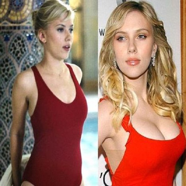 Scarlett Johansson Breasts Before After Boob Job.