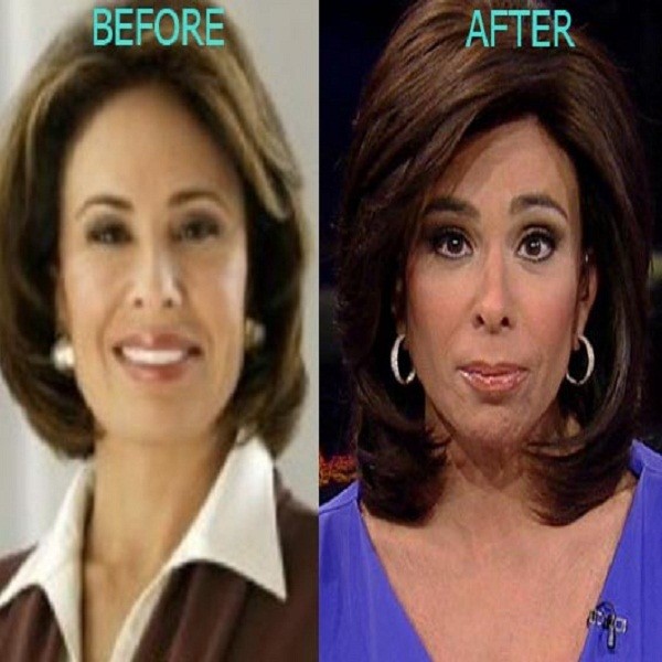 Jeanine Pirro Plastic Surgery Before and After Pictures.
