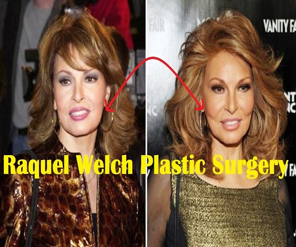 Raquel Welch Measurements & Plastic Surgery