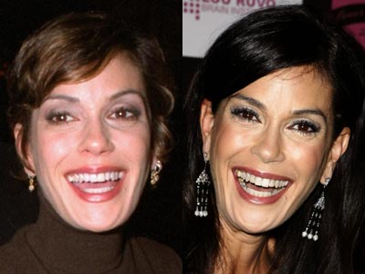 Teri Hatcher Plastic Surgery nose job - Brasizemeasurements.org