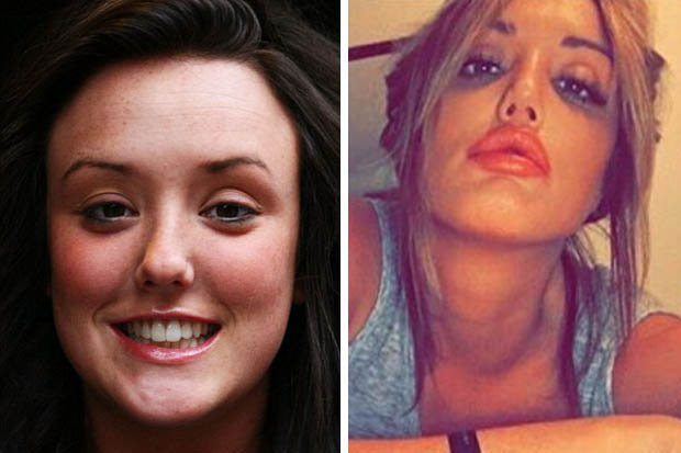 Charlotte Crosby shows off new pout